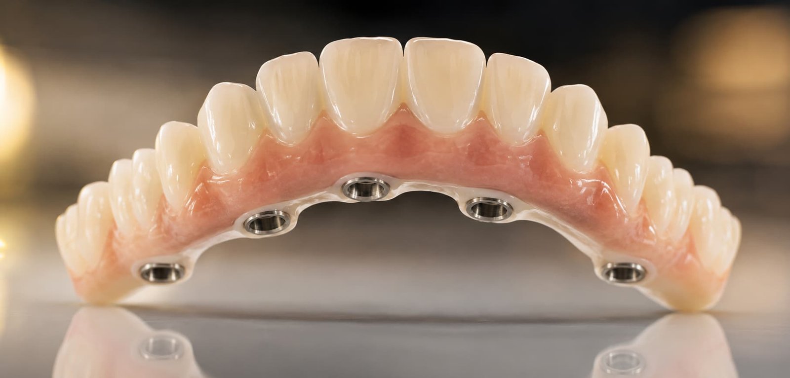 All-on-6 full arch zirconia prosthesis – Kocaqi Dental Clinic Tirana Albania